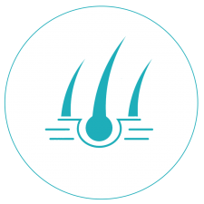 hirsutismo hirsutismo